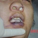 Raped young Chinese woman in morgue