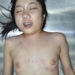Raped young Chinese woman in morgue