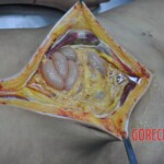 Raped young Chinese woman in morgue