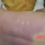 Raped young Chinese woman in morgue