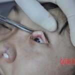 Raped young Chinese woman in morgue