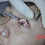 Raped young Chinese woman in morgue