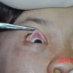 Raped young Chinese woman in morgue