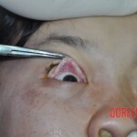 Raped young Chinese woman in morgue