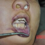 Raped young Chinese woman in morgue