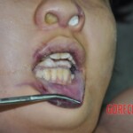 Raped young Chinese woman in morgue