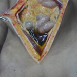 Raped young Chinese woman in morgue