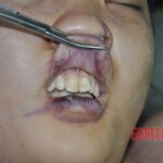 Raped young Chinese woman in morgue