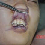 Raped young Chinese woman in morgue