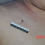 Raped young Chinese woman in morgue