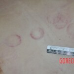 Raped young Chinese woman in morgue