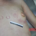 Raped young Chinese woman in morgue