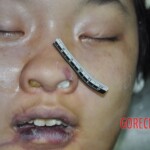 Raped young Chinese woman in morgue