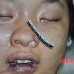 Raped young Chinese woman in morgue