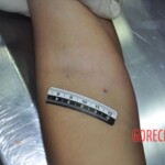 Raped young Chinese woman in morgue