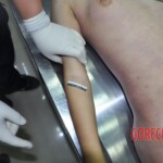 Raped young Chinese woman in morgue