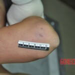 Raped young Chinese woman in morgue