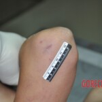 Raped young Chinese woman in morgue