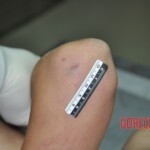 Raped young Chinese woman in morgue