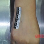 Raped young Chinese woman in morgue