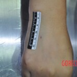 Raped young Chinese woman in morgue