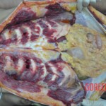 Raped young Chinese woman in morgue