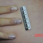 Raped young Chinese woman in morgue