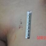 Raped young Chinese woman in morgue