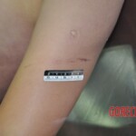 Raped young Chinese woman in morgue