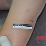 Raped young Chinese woman in morgue