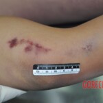 Raped young Chinese woman in morgue