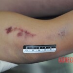 Raped young Chinese woman in morgue