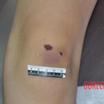 Raped young Chinese woman in morgue