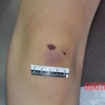 Raped young Chinese woman in morgue