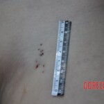 Raped young Chinese woman in morgue