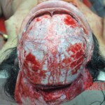 Raped young Chinese woman in morgue