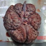 Raped young Chinese woman in morgue