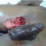 Man with severed dick