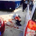 Man with severed dick