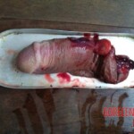 Man with severed dick