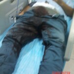 Man with severed dick