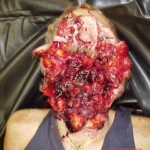 Face blown off