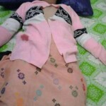 Children torn by mine