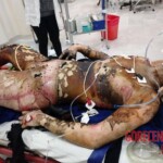 Mexico Ferrari accident