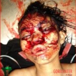 Young woman in morgue