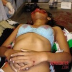 Young woman in morgue