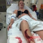 Florida shark attack