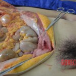 Autopsy of Chinese woman