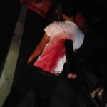 Biker impaled on pipe