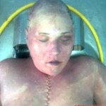 Brain extraction